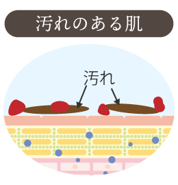 汚れのある肌図